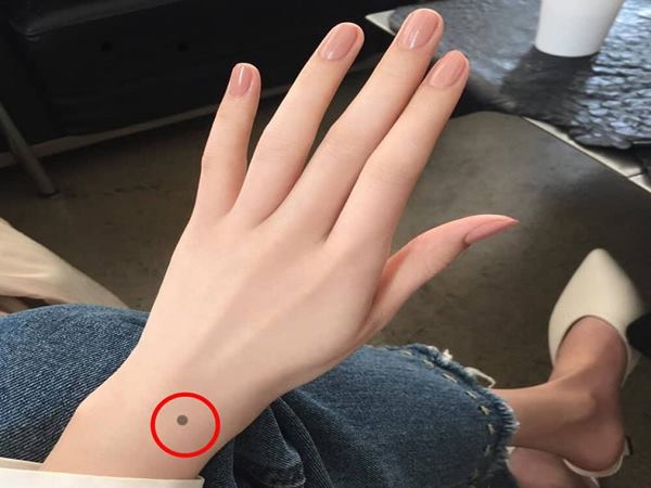 Nốt ruồi ở tay có ý nghĩa gì?